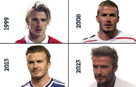 David Beckham Hair Transplant: How He Stopped Hair Loss - Hair System