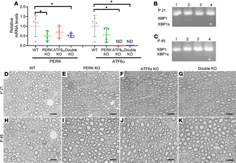 Mice With Double Deletion Of Perk And Atf6α In Schwann Cells Showed