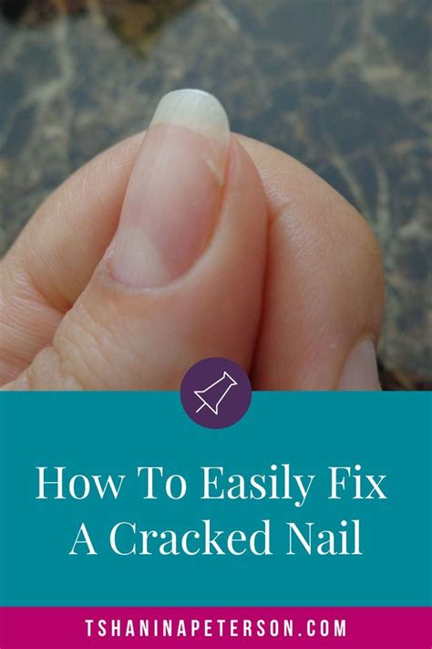 Easy Steps To Fix A Cracked Nail At Home Tshanina Peterson Nails