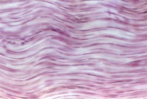 Dense Regular Connective Tissue Histology