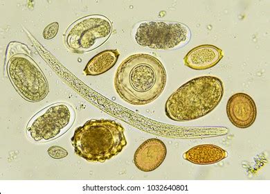 Mixed Helminthes Stool Analyze By Microscope Stock Photo 1032640801 ...