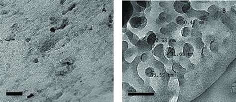 Tem Images And Size Distribution Of Chitosan Nanoparticles Download Scientific Diagram