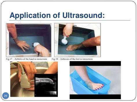 Therapeutic Ultrasound for Physiotherapy students