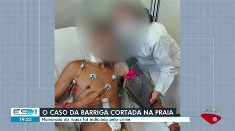 Barriga Cortada Em Praia Jovem Teve Debilidade Permanente Do