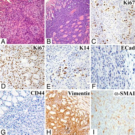 Distinct Populations Of Tumor Initiating Cells Derived From A Tumor