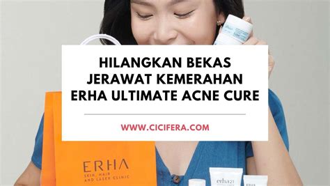 Hilangkan Bekas Jerawat Kemerahan Dengan Erha Ultimate Acne Center