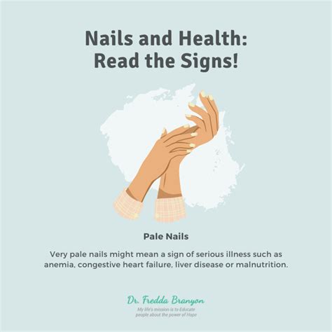 What Do Your Nails Say About Your Health Hubpages