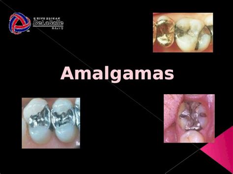 PPTX La Amalgama Es Un Material de Restauración DOKUMEN TIPS