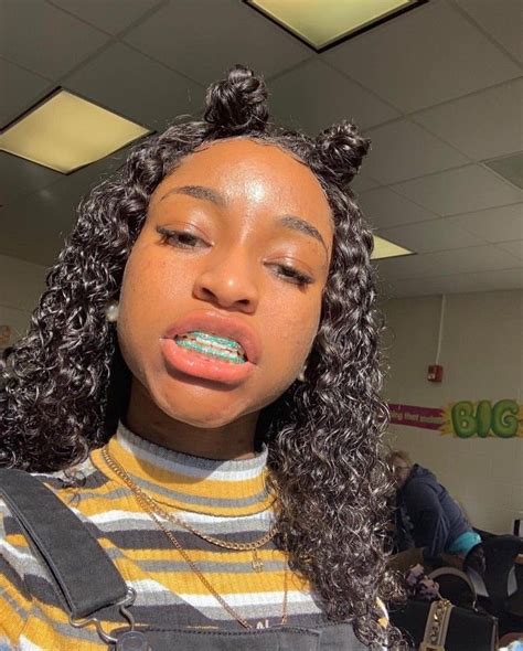 Follow Kemzinoo For More ρoρρin Pins ️ Cute Braces Braces Smile