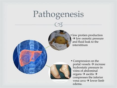 Generalized Anasarca Ppt