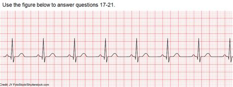 Ecg Ekg Interpretation Basic Quiz For Nurses