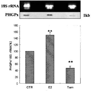 Northern Blotting Analysis For PHGPx MRNA In Rat Testes Treated With