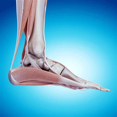 Posterior Tibial Tendon Tear Ankle