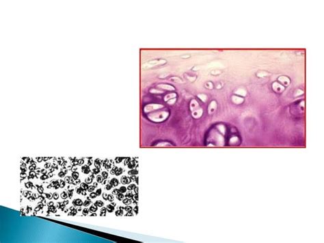 jaringan tulang sejati pptx