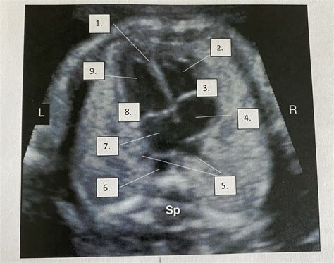 EMBRYO UNIT 1 Diagram Quizlet