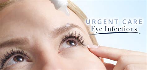 Urgent Care Eye Infections Southern Dutchess Eye Care