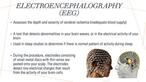 EEG Flashcards Quizlet