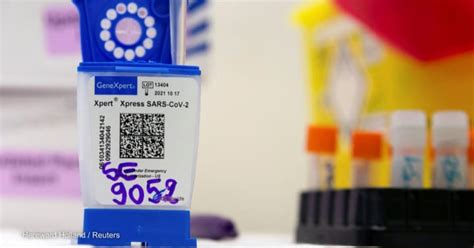 Fingerstick blood test can be a promising TB screening tool, study finds | Devex