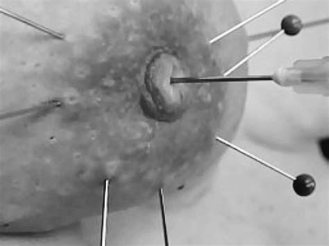 Needle Nude Pics Xhamster