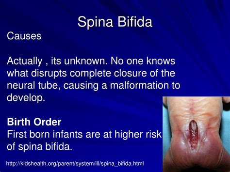 Spina Bifida Pathophysiology