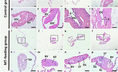 Gonad Histology Analysis During Methyltestosterone Mt Induced Sex Download Scientific Diagram