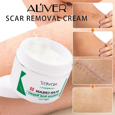 Aliver Body Scar Cream Old Scar Removal Gel Repairs Stretch Marks