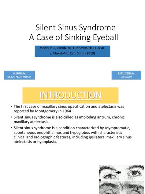 Silent Sinus Syndrome Pdf Causes Of Death Human Head And Neck