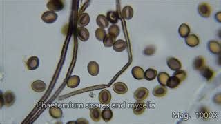 Fungal Spores Under Microscope