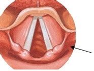 Speech Hearing Mechanism MUSCLES Chapter 4 Anatomy Of Phonation