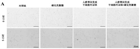 一种水凝胶及其制备方法和应用与流程