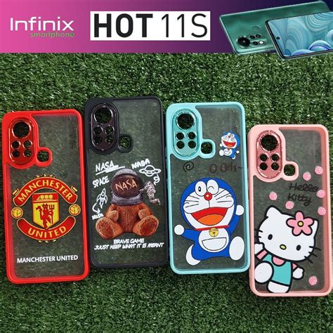 Infinix Hot S Shopee