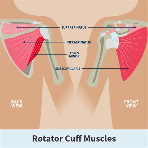 Rotator Cuff Tears | Florida Orthopaedic Institute