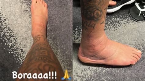 Seleção Neymar compartilha foto de tornozelo inchado após lesão