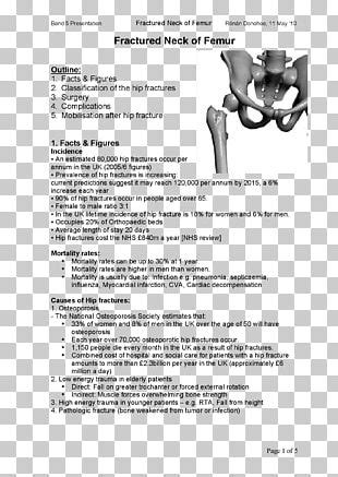 Bone Fracture Diagram Femoral Fracture Femur PNG, Clipart, Arm, Bone ...