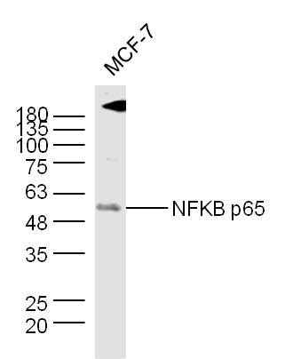 Rabbit Anti Nfkb P Polyclonal Antibody Absin