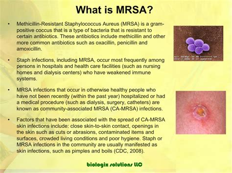 Methicillin Resistant Staphylococcus Aureus Infection As Related To