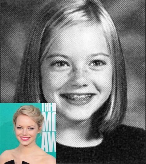 12 best Celebrities with Braces images on Pinterest | Celebrities with ...