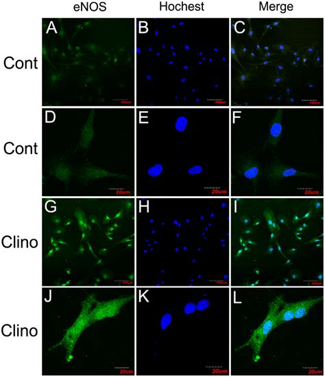 Simulated Microgravity Increases Enos Expression In Huvec C Confocal Download Scientific