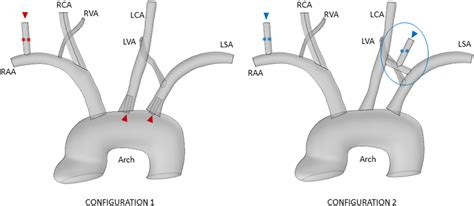 Patient‐specific Aortic Model With Geometrical Reconstruction Download Scientific Diagram