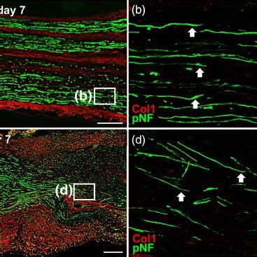 Connective tissue (epineurium + mesoneurium) diameters of EGF (+)-1 and ...