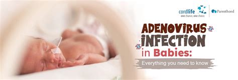 Adenovirus Infection In Babies Everything You Need To Know