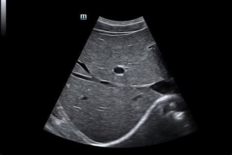 Ec Grafo Dc X Insight De Mindray Para Fisioterapia Helios Medical