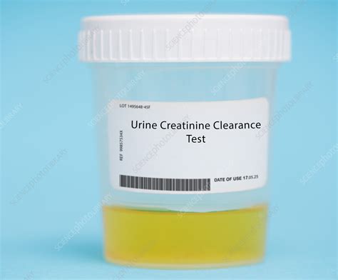 Urine Creatinine Clearance Test Stock Image F Science