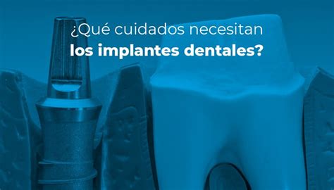 Qué cuidados necesitan los implantes dentales CCM Dental