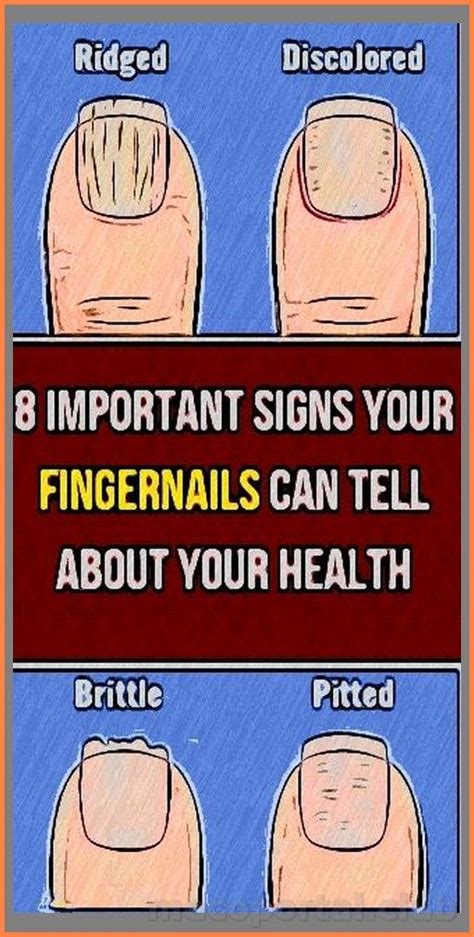 8 Important Signs Your Fingernails Can Tell About Your Health Artofit