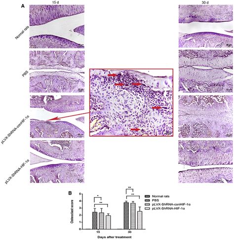 Analysis Of Osteoclasts And Pannus Staining And Quantitative Analysis Download Scientific