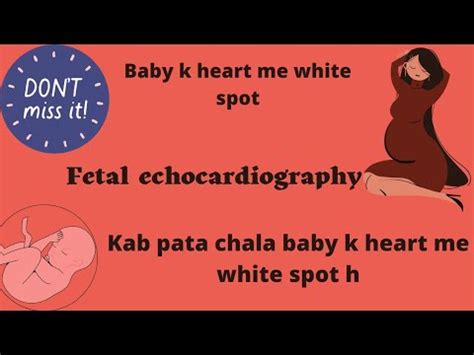 Echogenic Focus Fetal Echocardiography YouTube