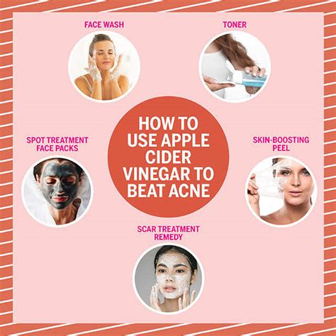 Apple cider vinegar cures acne