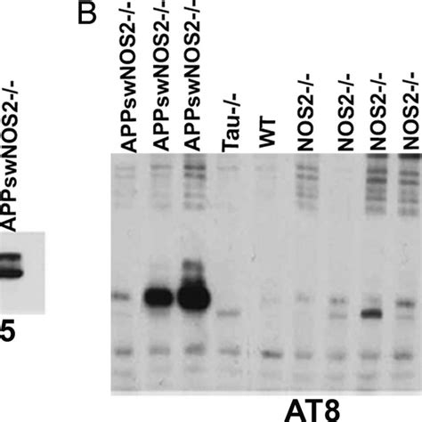 Western Blot Confirms The Presence Of Hyperphosphorylated Tau In