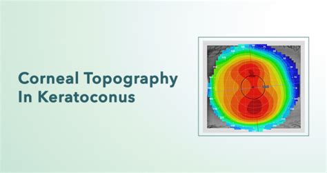 All You Need To Know About Cornea Transplant Surgery Corneal Transplant